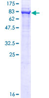 ab161568 on a 12.5% SDS-PAGE stained with Coomassie Blue.
