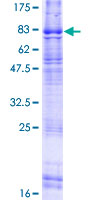 ab163786 on a 12.5% SDS-PAGE stained with Coomassie Blue.