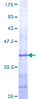 ab163787 on a 12.5% SDS-PAGE stained with Coomassie Blue.
