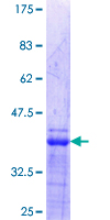 ab158386 on a 12.5% SDS-PAGE stained with Coomassie Blue.