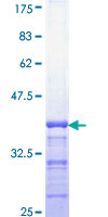 ab158388 on a 12.5% SDS-PAGE stained with Coomassie Blue.