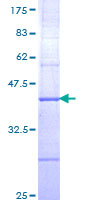 ab158390 on a 12.5% SDS-PAGE stained with Coomassie Blue.