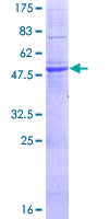 ab160877 on a 12.5% SDS-PAGE stained with Coomassie Blue.