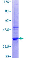 ab160878 on a 12.5% SDS-PAGE stained with Coomassie Blue.