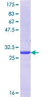 ab165548 on a 12.5% SDS-PAGE stained with Coomassie Blue.