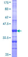 ab163210 on a 12.5% SDS-PAGE stained with Coomassie Blue.