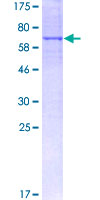 ab162388 on a 12.5% SDS-PAGE stained with Coomassie Blue.