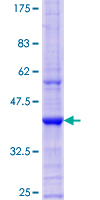 ab162389 on a 12.5% SDS-PAGE stained with Coomassie Blue.
