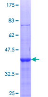 ab162765 on a 12.5% SDS-PAGE stained with Coomassie Blue.