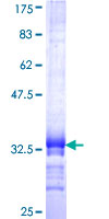 ab165141 on a 12.5% SDS-PAGE stained with Coomassie Blue.