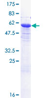 ab161502 on a 12.5% SDS-PAGE stained with Coomassie Blue.