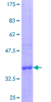 ab161503 on a 12.5% SDS-PAGE stained with Coomassie Blue.