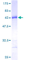 ab161419 on a 12.5% SDS-PAGE stained with Coomassie Blue.