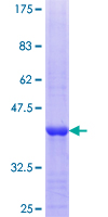 ab161420 on a 12.5% SDS-PAGE stained with Coomassie Blue.