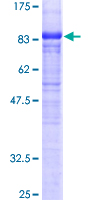ab161962 on a 12.5% SDS-PAGE stained with Coomassie Blue.