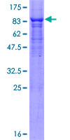 ab161963 on a 12.5% SDS-PAGE stained with Coomassie Blue.