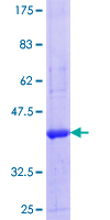 ab161964 on a 12.5% SDS-PAGE stained with Coomassie Blue.