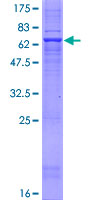 ab163991 on a 12.5% SDS-PAGE stained with Coomassie Blue.