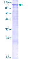 ab163555 on a 12.5% SDS-PAGE stained with Coomassie Blue.