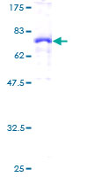 12.5% SDS-PAGE stained with Coomassie Blue showing ab131757.