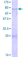 12.5% SDS-PAGE stained with Coomassie Blue showing ab131759.