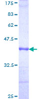 ab158723 on a 12.5% SDS-PAGE stained with Coomassie Blue.