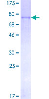 ab158405 on a 12.5% SDS-PAGE stained with Coomassie Blue.