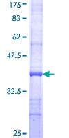 ab158404 on a 12.5% SDS-PAGE stained with Coomassie Blue.
