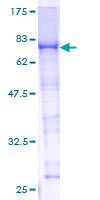 ab158407 on a 12.5% SDS-PAGE stained with Coomassie Blue.