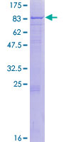 ab158408 on a 12.5% SDS-PAGE stained with Coomassie Blue.
