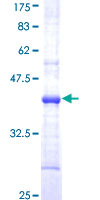 ab158409 on a 12.5% SDS-PAGE stained with Coomassie Blue.