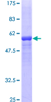 ab158410 on a 12.5% SDS-PAGE stained with Coomassie Blue.