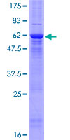 ab158411 on a 12.5% SDS-PAGE stained with Coomassie Blue.