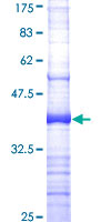 ab158412 on a 12.5% SDS-PAGE stained with Coomassie Blue.