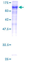 ab158413 on a 12.5% SDS-PAGE stained with Coomassie Blue.