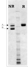 Lane 1 : Non-reduced Factor XIIIa protein (ab62412) at 1 µg Lane 2 : Molecular weight standard Lane 3 : Reduced Factor XIIIa protein (ab62412) at 1 µg Notes: In the non-reduced sample the A chain shifts down toward the B chain following activation.