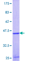 ab160481 on a 12.5% SDS-PAGE stained with Coomassie Blue.