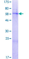 ab162390 on a 12.5% SDS-PAGE stained with Coomassie Blue.