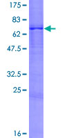 ab160385 on a 12.5% SDS-PAGE stained with Coomassie Blue.