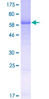 ab166183 on a 12.5% SDS-PAGE stained with Coomassie Blue.