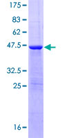 ab161335 on a 12.5% SDS-PAGE stained with Coomassie Blue.