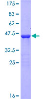 ab164416 on a 12.5% SDS-PAGE stained with Coomassie Blue.