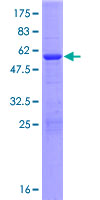 ab162416 on a 12.5% SDS-PAGE stained with Coomassie Blue.