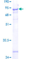 ab163876 on a 12.5% SDS-PAGE stained with Coomassie Blue.