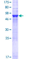 ab164337 on a 12.5% SDS-PAGE stained with Coomassie Blue.