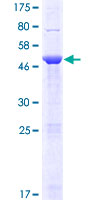 ab165621 on a 12.5% SDS-PAGE stained with Coomassie Blue.