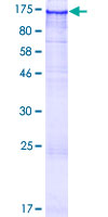 ab164599 on a 12.5% SDS-PAGE stained with Coomassie Blue.