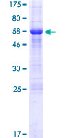 ab165949 on a 12.5% SDS-PAGE stained with Coomassie Blue.