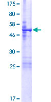 ab164784 on a 12.5% SDS-PAGE stained with Coomassie Blue.