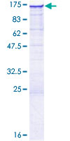ab162502 on a 12.5% SDS-PAGE stained with Coomassie Blue.